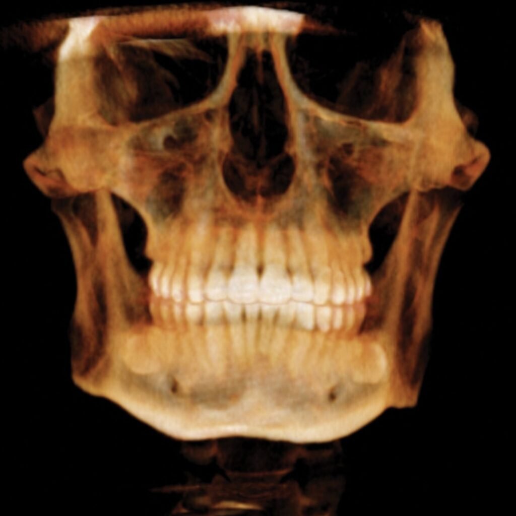 3d Scan Oracle CBCT