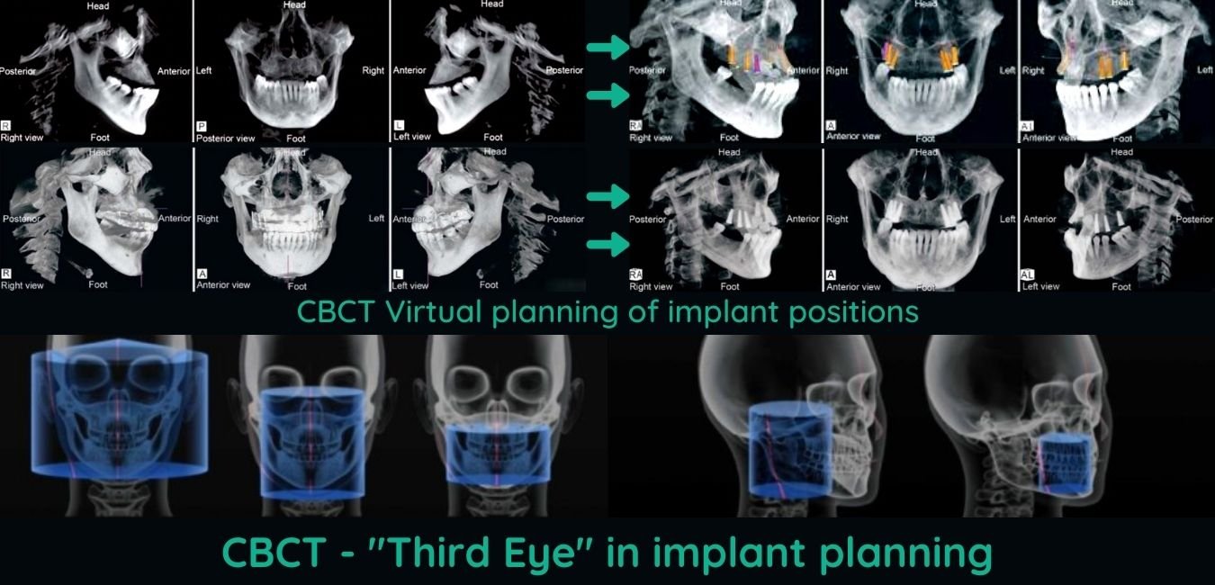 Oracle CBCT Banner 1