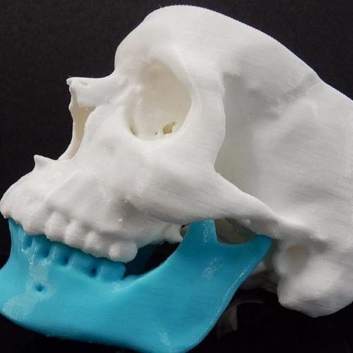3D printing Oracle CBCT 3D printing Oracle CBCT