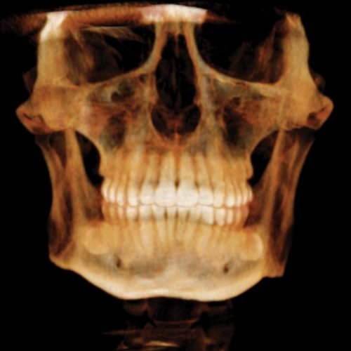 3d Scan Oracle CBCT 3d Scan Oracle CBCT